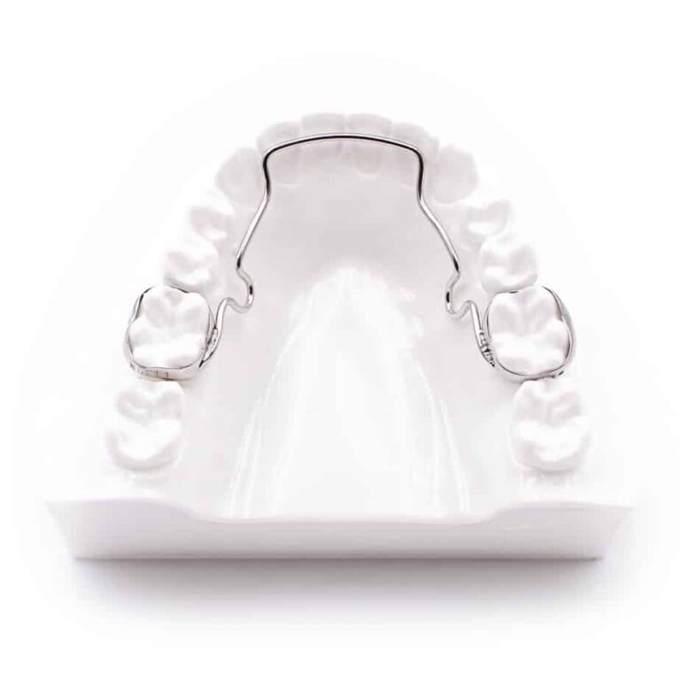 Retainers – Bussick Orthodontics