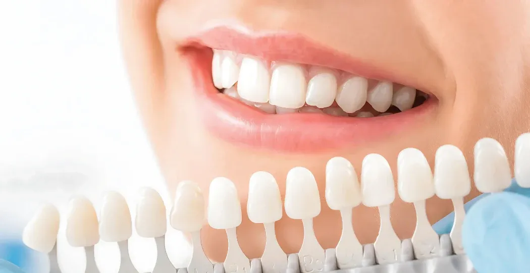 Close-up of a bright, straight smile