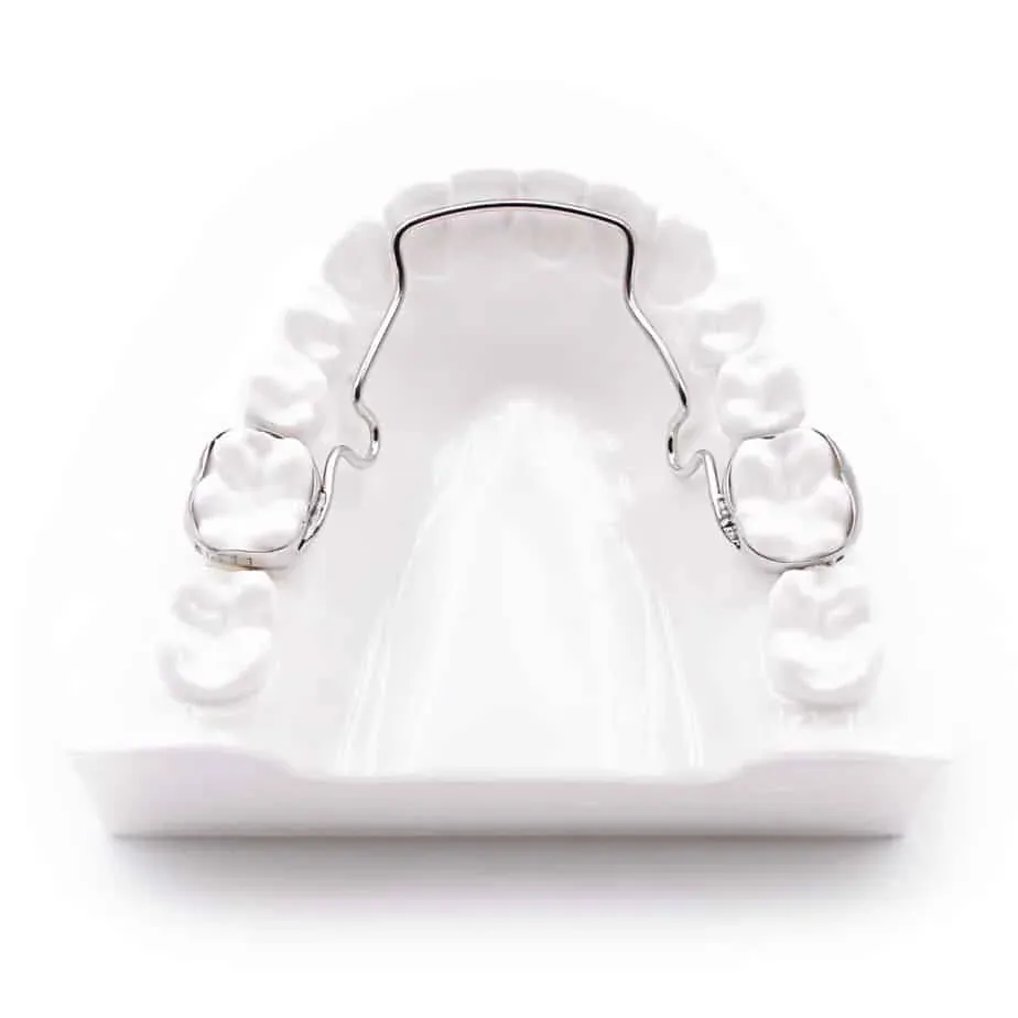 Clear removable retainer on an upper arch